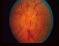 Aion Eye